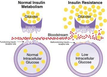 signs of metabolic syndrome