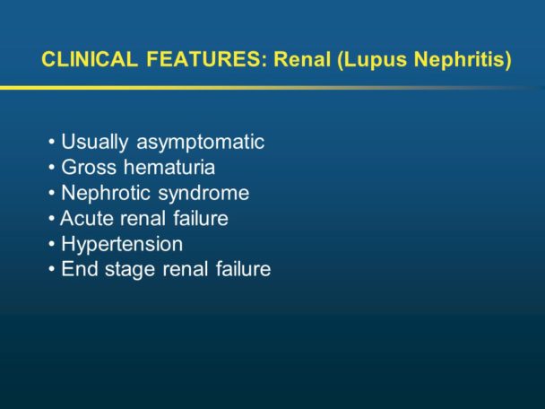 lupus kidney failure