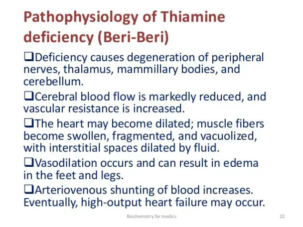 heart disease and thiamine