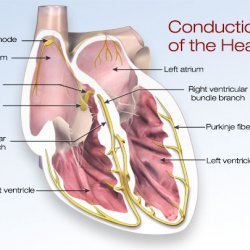 Atrial fib and Tpa treatment.