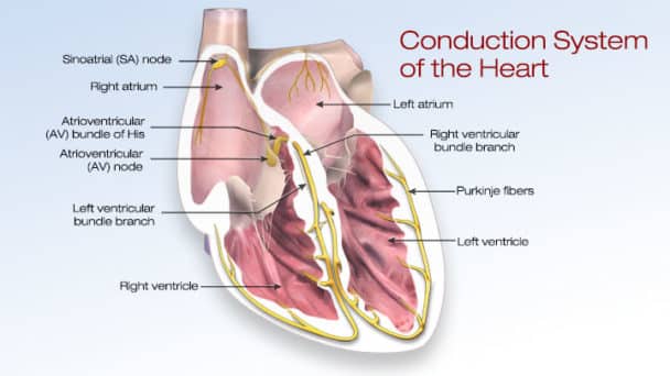 Atrial fib and Tpa  are used for stroke