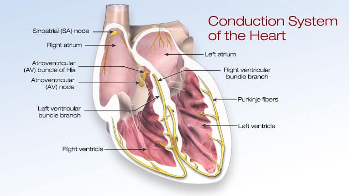 Atrial fib and Tpa treatment.