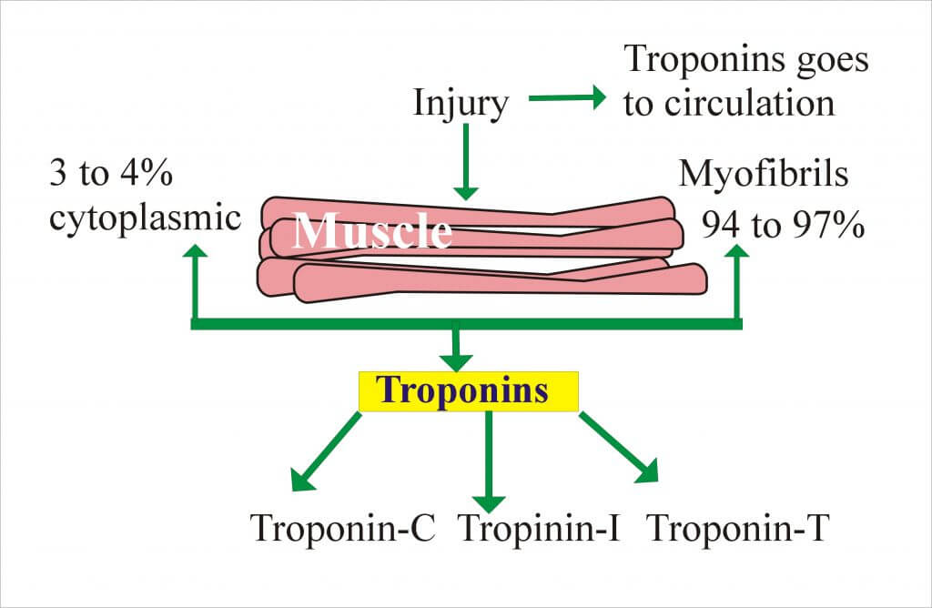 Normal Troponin Levels Chart