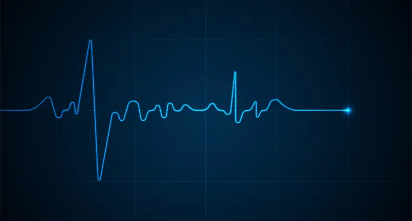 What does an EKG look like with pictures.