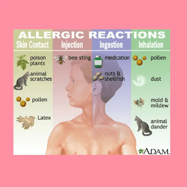 What Triggers Allergic Asthma and Non-Prescription Options for Asthma