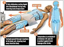 Therapeutic Hypothermia Protocol and Saving the Brain After a Heart Attack