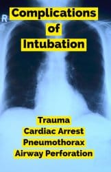 Upper airway obstruction, positive airway pressure, risk factors for intubation