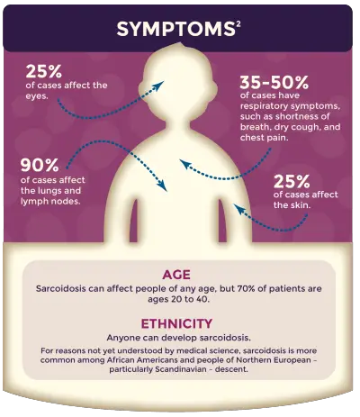 Sarcoidosis Signs and Causes 