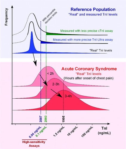 normal troponin level