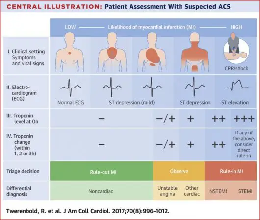 heart-attack-troponin-levels-chart