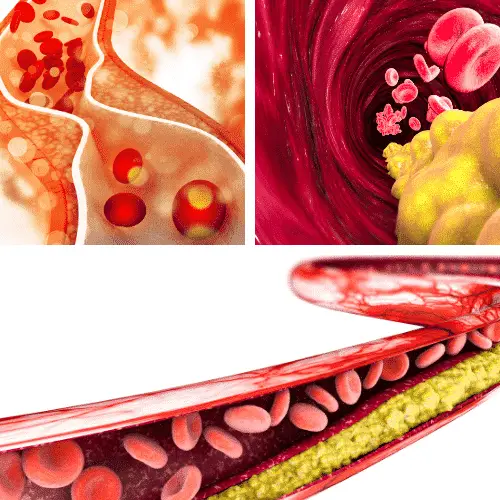 How to lower cholesterol naturally.