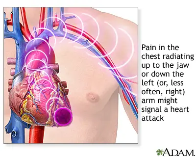 Widowmaker Heart Attack Facts