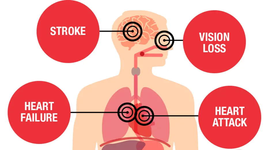 Complications of high blood pressure