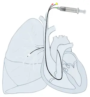 Cardiac Catheterization