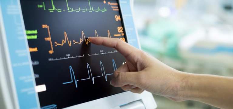 Can EKG'S detect blockages?